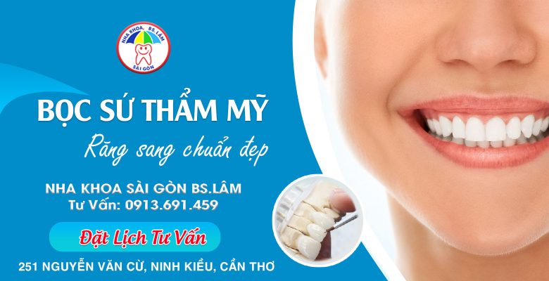 Bọc răng sứ thẩm mỹ là gì? Bọc răng sứ Cần Thơ