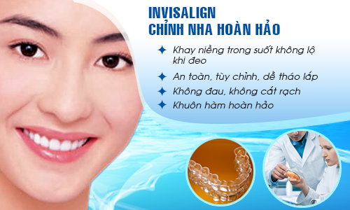Lưu ý khi niềng răng invisalign