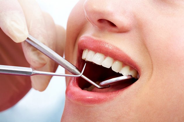 Chảy máu sau nhổ răng | Kiến thức nhổ răng