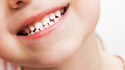 Vai trò của răng sữa và cách chăm sóc
