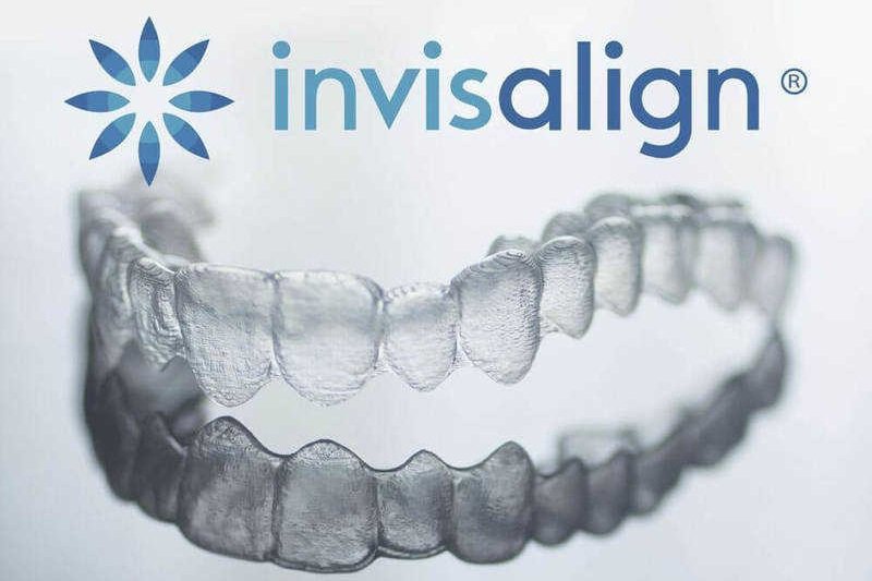 Niềng răng trong suốt invisalign